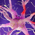 Is it hard to prove nerve damage?