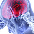 Is a herniated disc a serious injury?