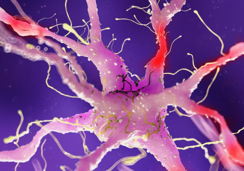 How do you prove you have nerve damage?