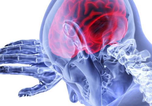 Is a herniated disc a serious injury?